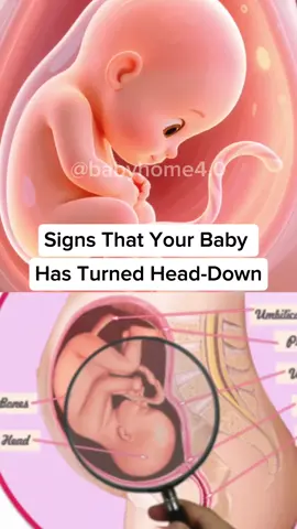 Signs that your baby has turned head down #firstparent #baby #tipsparent #pregnant #raisechildren 