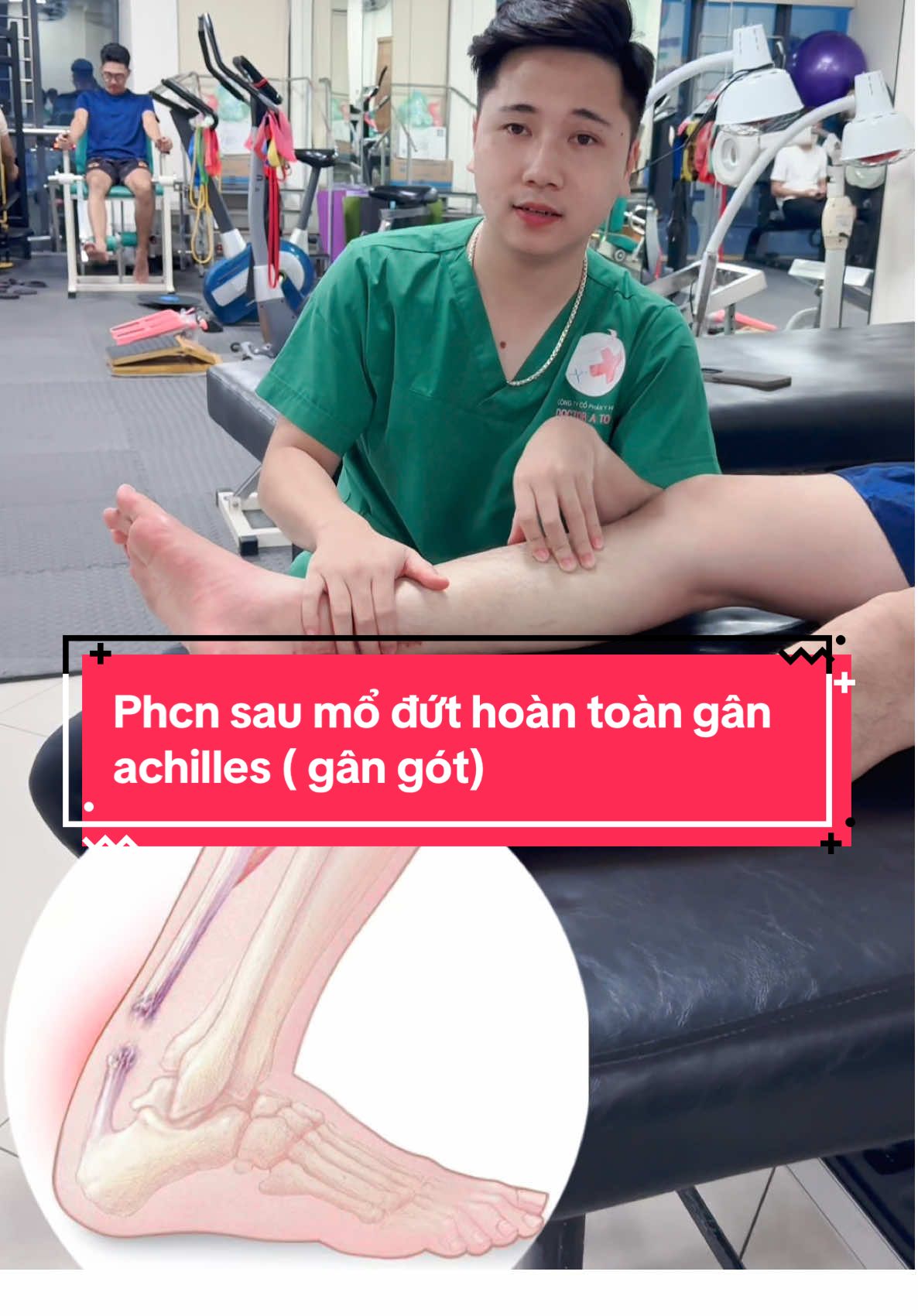 #CapCut Phục hồi gân Achilles không chỉ là luyện tập, mà là hành trình lấy lại từng bước đi vững chắc. Kiên trì – chính là liều thuốc mạnh nhất 💪 #trungtamphuchoichucnangvietphap #achilles #dutgangot @Bác Sĩ Đại 
