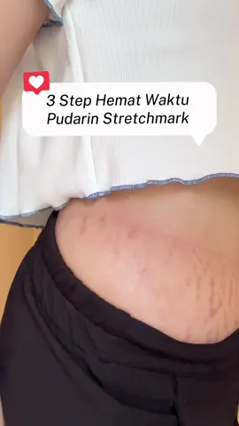 Trimester 3 tuh dibuat kaget karna banyak stretchmark muncul😭 untungnya nemu perawatan hemat waktu untuk bantu pudarin stretchmark dari @Ciara Indonesia  #stretchmarks #stretchmark #stretchmarkserum #stretchmarkoil #ciaraindonesia 