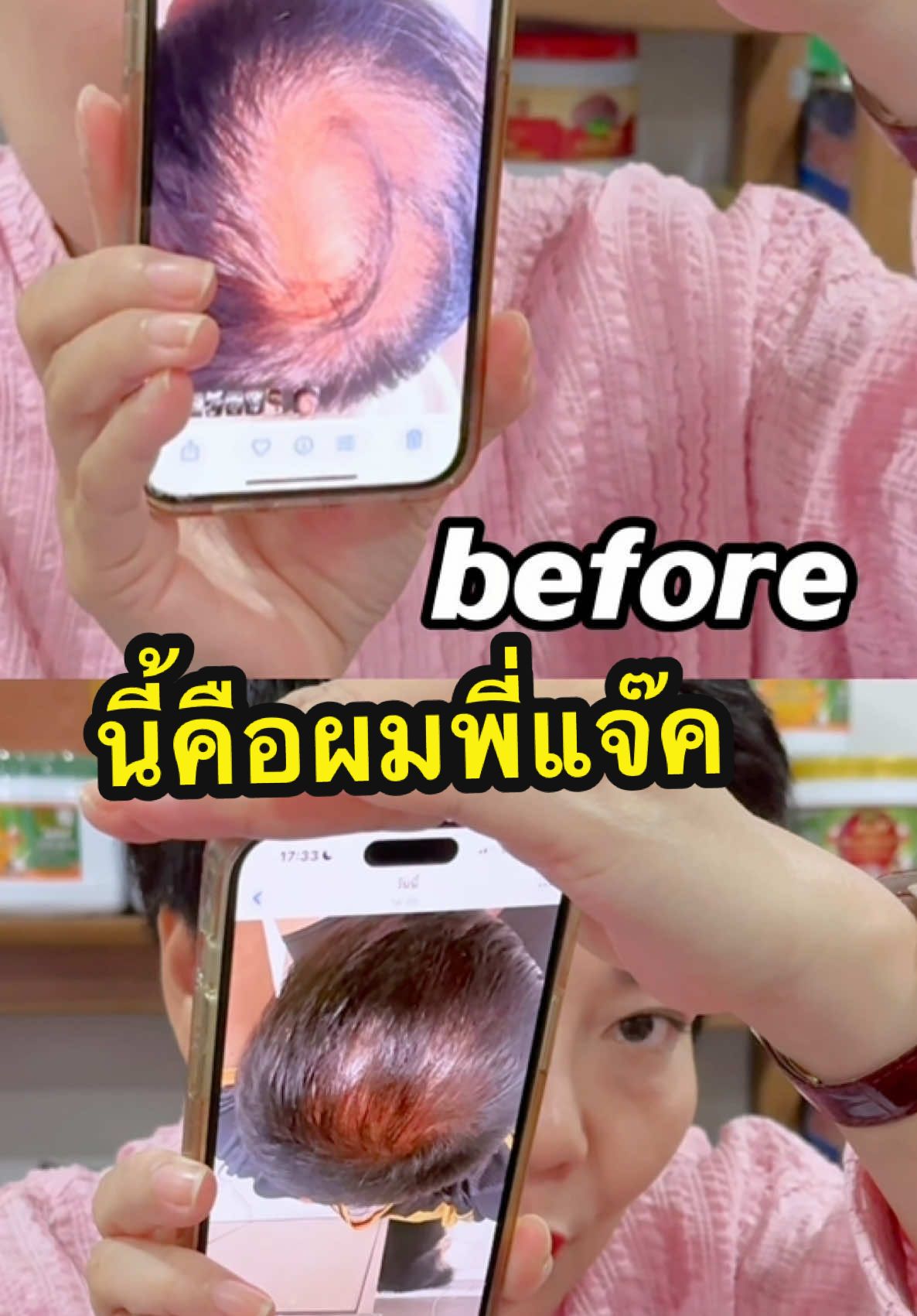 เพื่อนๆเจอปัญหาแบบกันหรือเปล่าค่ะ#ปัญหาเส้นผมและหนังศีรษะ #ใช้ดีบอกต่อค่ะ #กดสั่งตะกร้าสีเหลืองได้เลยแม่ #ต้องลองๆ #พี่ไก่รัญจวน 
