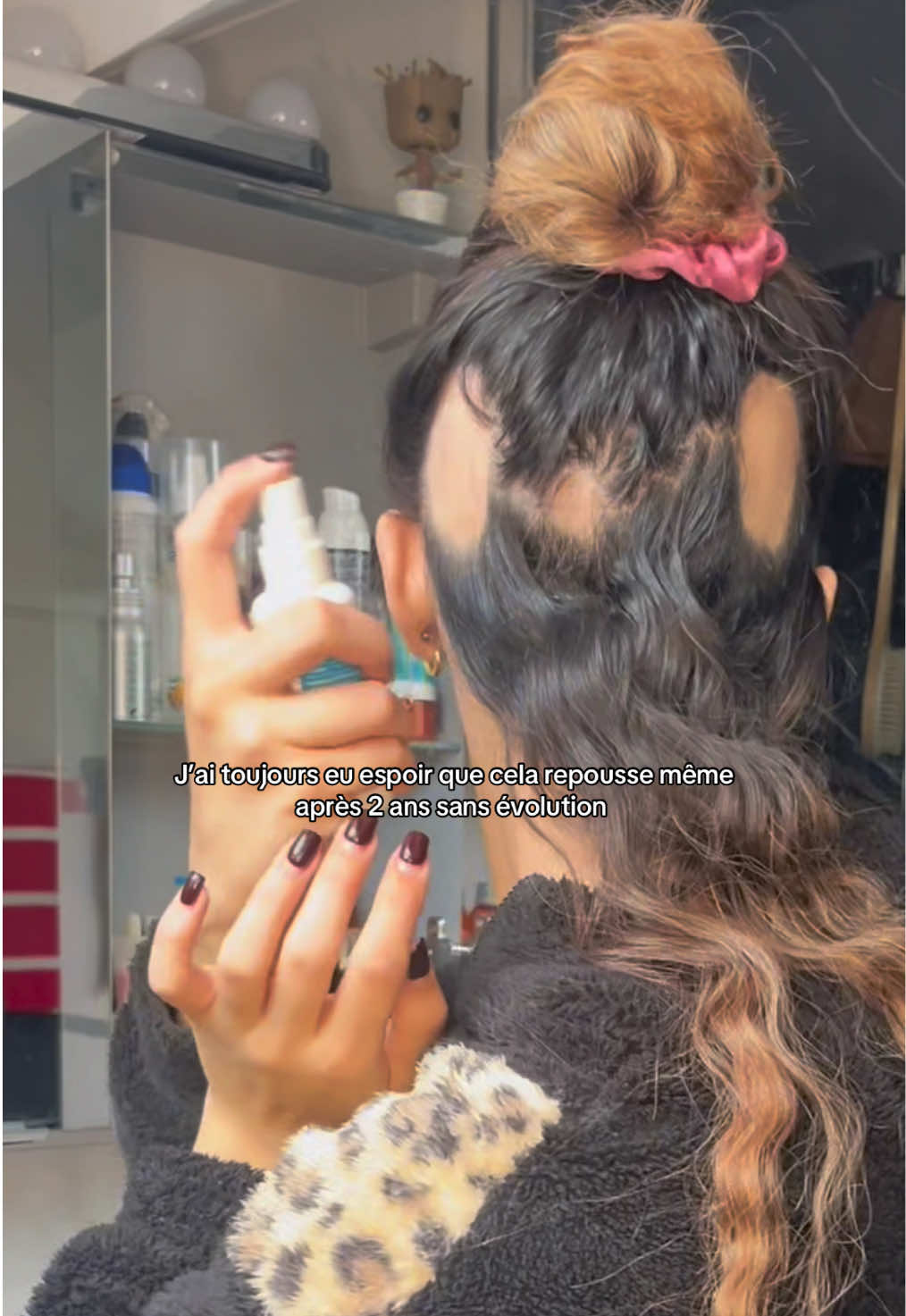 Tout vient à point à qui sait attendre 🥹❤️  #fyp #cheveux #hair #choc #pelade 