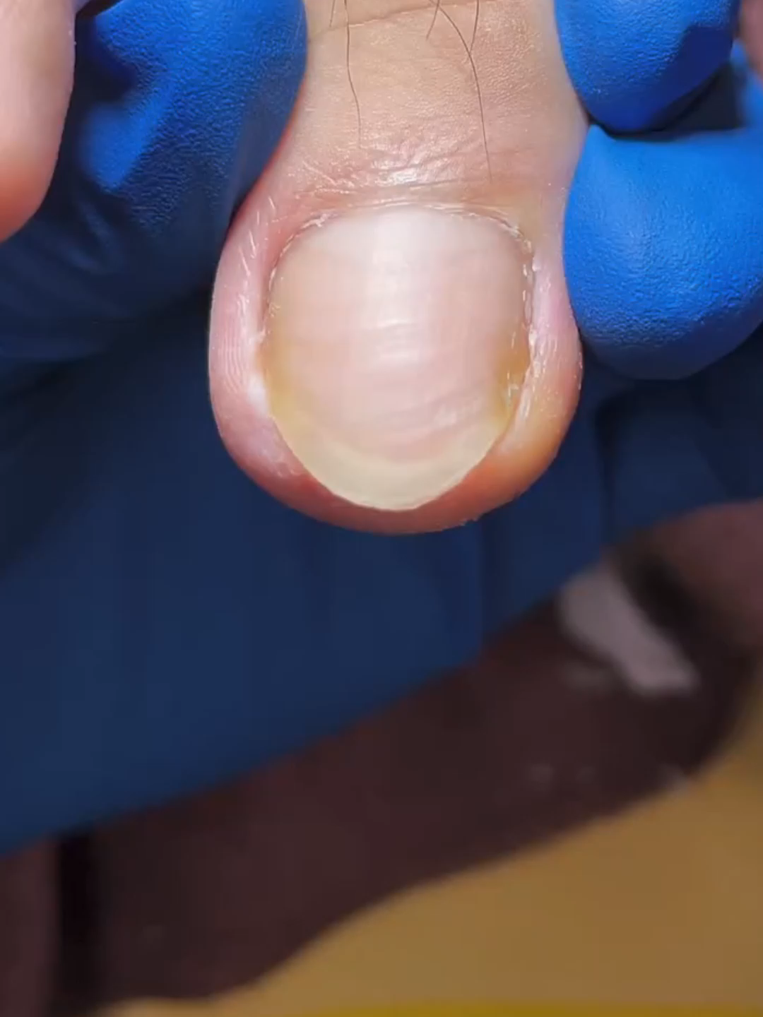 #nails #asmrnailsalon #pedicure #asmr #asmrnails #toecleaning
