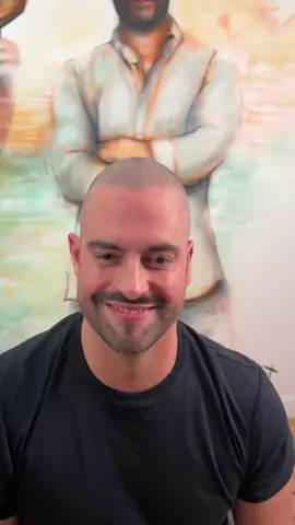 This hair loss transformation is crazy 🤯 #scalpmicropigmentation #hairtattoo #scalptattoo 