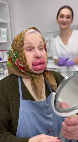 Отправь той самой, которая собирается колоть губы)) #2025 #funny #tiktok #lips #top 