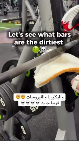 يمممه انا من زمان كنت  عندي وسواس من بكتيريا 🦠 الهربس يجيك حتى من المصافحه🥲🥲🥲💔💔💔 وفيروس الكبد الوبائي وفيروس السل افانا الله وياكم #فيروسات #تنسيقات_ميم_فتنس🧢 #الرياضة_عشق_لا_ينتهي♠️💪 #اكسبلورexplore 