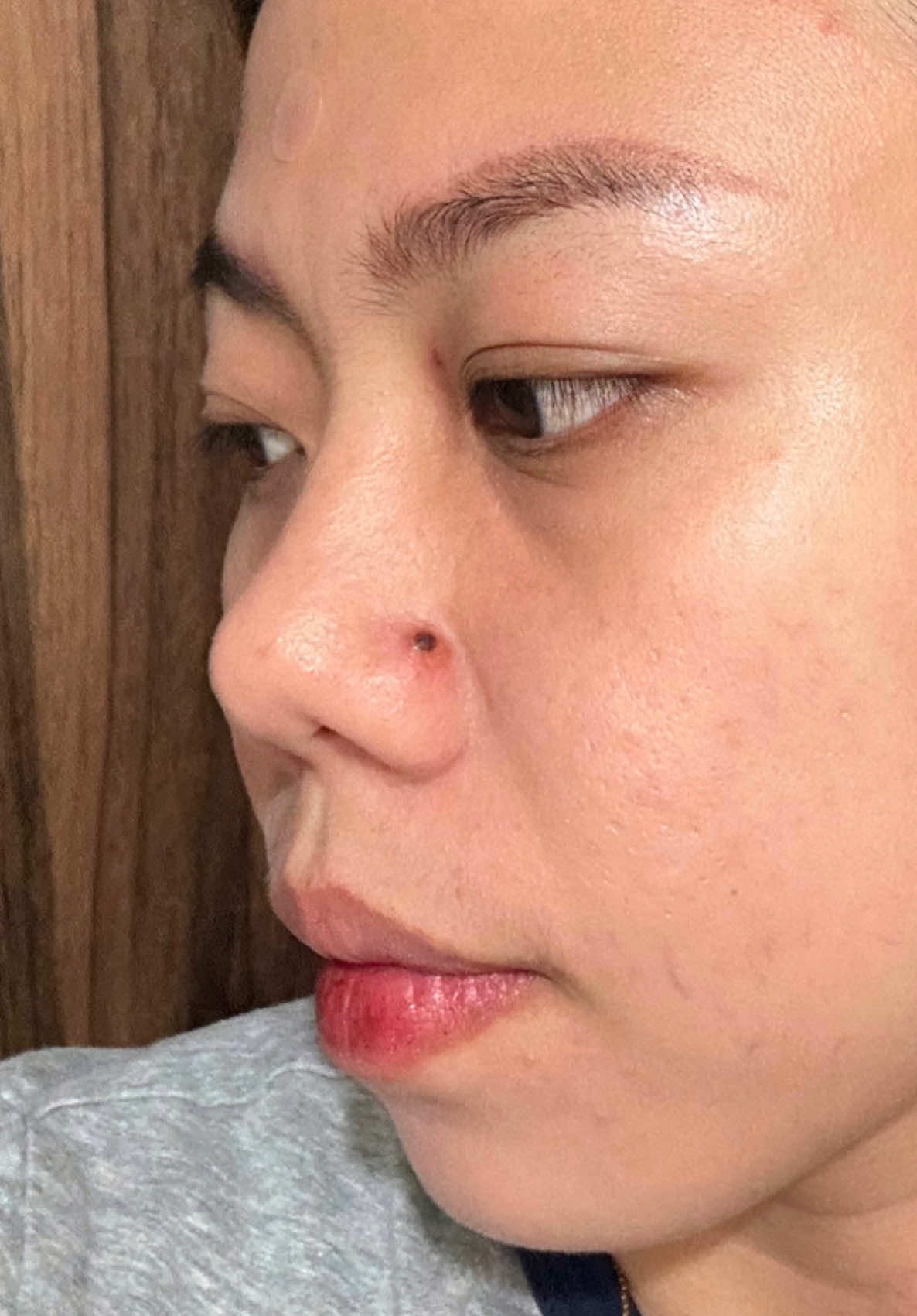 After 30 years of having this mole, I can't believe this is what finally got rid of it. 🥺 #mole #moleremoval #kasoycream #wartsremoval #skintagremoval 