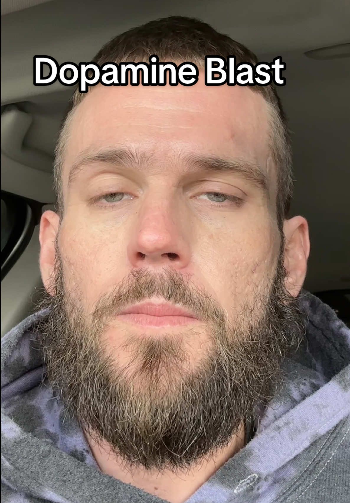 This is me practicing my song “dopamine blast”  off my upcoming album. This is all #addiction #recovery #MentalHealth #rap #music I was homeless in active addiction for ten years and now I got something to do . Instrumental by h3music as usual 