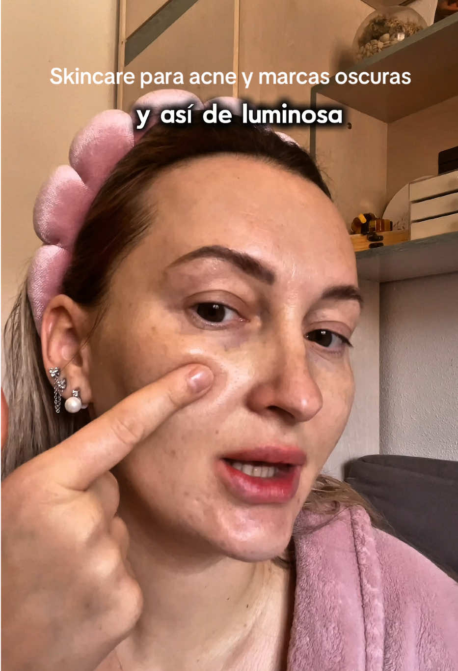 Publi de mi rutina de skincare coreano para cuidar mi piel con acné y marcas oscuras a causa de mis cambios hormonales de los últimos años.  1. Espuma Limpiadora Heartleaf Quercetinol Pore Deep Cleansing Foam  2. Tónico Rice 70 Glow Milky Toner 3. Sérum con Niacinamida 10% + TXA 4%  4. Protector solar Heartleaf Silky Moisture  Todos son de la marca @anua_global y los pedí en @YesStyle  Puedes usar mi código DIDI0729 para tener un descuento extra en todos tus pedidos  #anua #acnescars #darkspots #sunspots #brightening yesstyle niaciamide KoreanSkincare GlassSkin KBeauty hype SkinClarity RiceWater skincare 