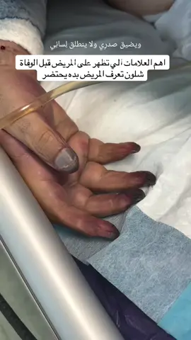 Pre_death signs #explor #nursingstudent #hospital #سريع #الشغب_الصيني_مال_حال😂😂 