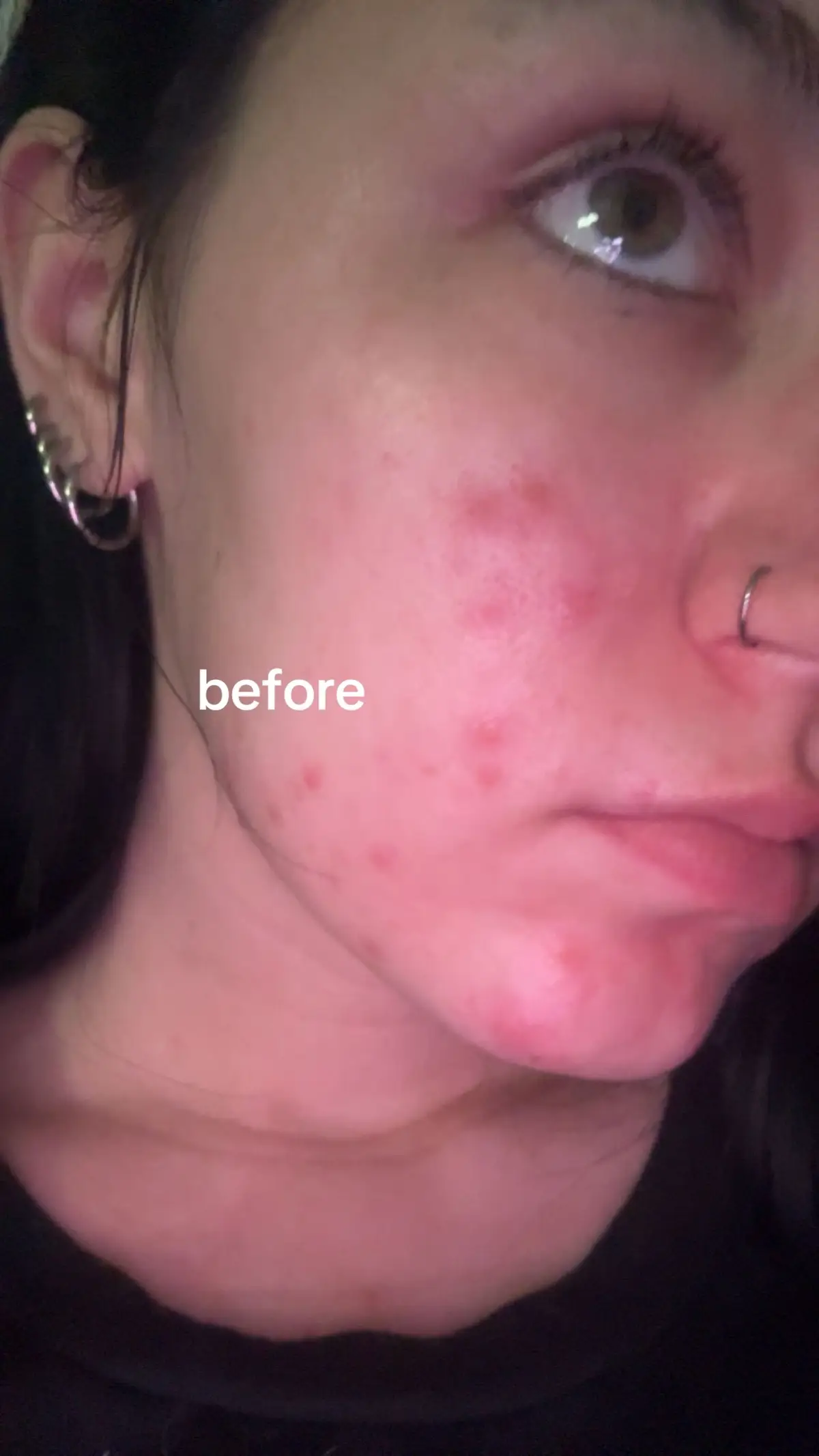 still some ways to go but looks so much better and i’ve only thrown up once 🤗