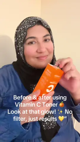 🍊✨ “This Vitamin C toner gives your skin a fresh, bright, and glowing look. Use it daily and enjoy your natural glow!” 🌿💧