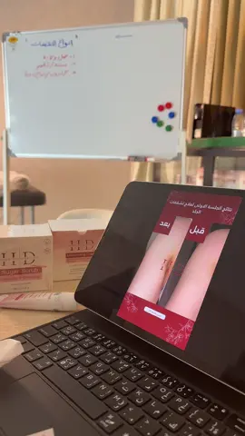 ✨ من أولى الجلسات والنتائج تتكلم بنفسها! بدون كدمات، بدون تصبغات، مراحل استشفاء ناعمة ونتيجة تبهر 💫 💬 عميلاتنا دايم يقولون “ما توقعنا النتيجة من أول جلسة!” وهذا هو سر بروتوكولات هدى دستنيشن المعتمدة 👑 🎁 بمناسبة الأخبار الحلوة ورضا عميلاتنا — أطلقنا عرض خاص لأول 10 عملاء فقط الفرصة لتجربة علاجنا الاحترافي لجميع أنواع التشققات 💆🏻‍♀️ 📩 احجزي الآن قبل ما تخلص المقاعد! #هدى_دستنيشن #علاج_تشققات_الجسم #نتائج_ملموسة #عناية_بالبشرة #جلسات_تجميلية     #
