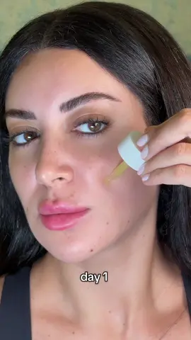 ايه رأيكم ؟ 🤗 #skin1004 #koreanskincare #centellaskincare #retinol #ampoule @SKIN1004 US 