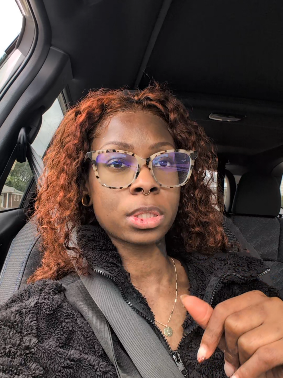 I got a whole booty cheek on my lip😒 lupus vs infection  #foryoupage