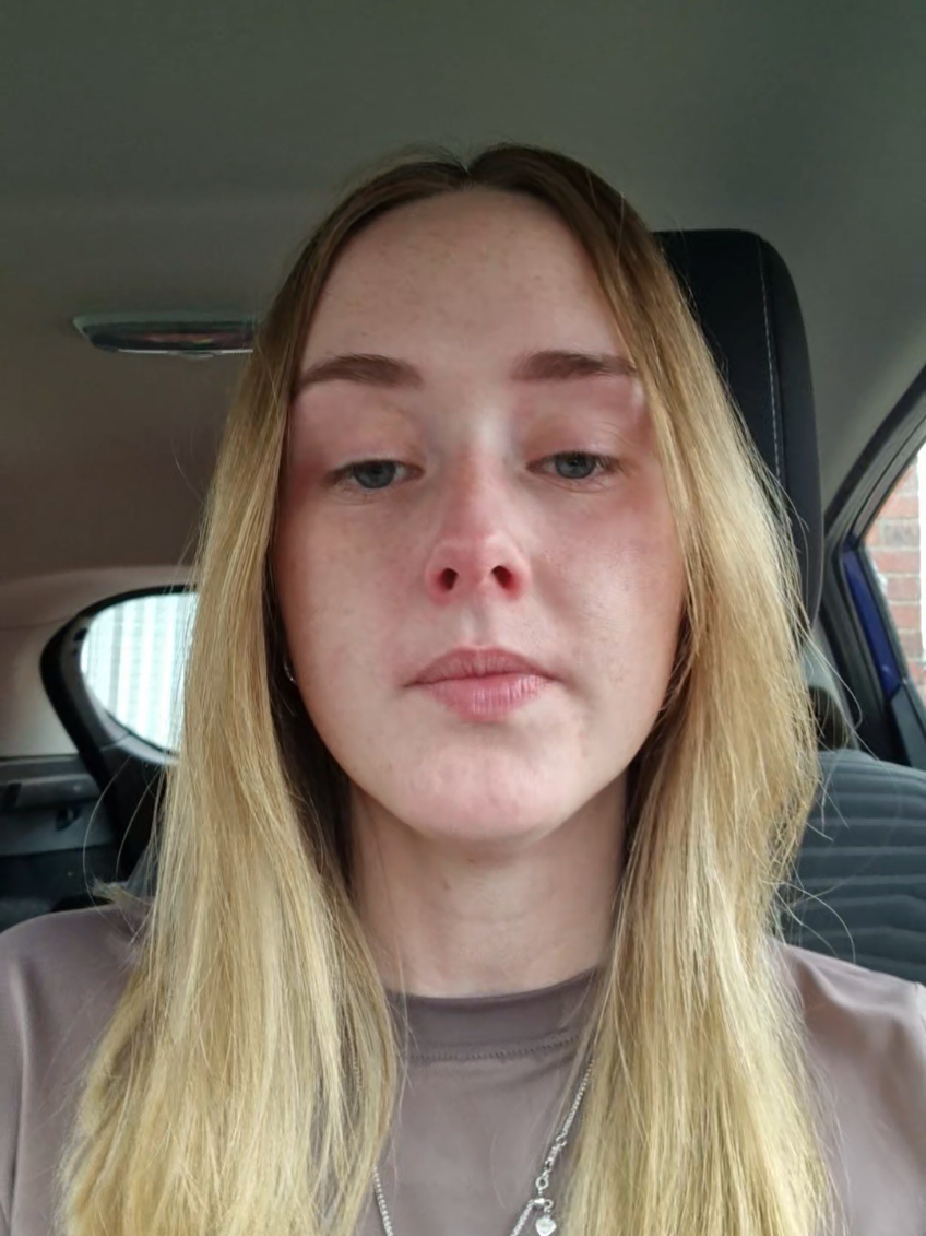 I never thought I’d post something like this. I’m just a mum trying to save her baby’s life. The NHS can’t do the surgery he needs, we have to get him to America. We've raised £50k so far, but we don’t have forever. Ollie needs this surgery before it’s too late. Please share. 💙 #saveollie #momtok #heartwarrior #angst #fyp 