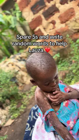 ⚠️ Sensitive Content | EB Awareness This video is shared to raise awareness about Epidermolysis Bullosa (EB) — a rare skin condition that causes fragile skin and painful wounds. Please share love, not hate. 💙 #EBAwareness #RareDisease #SupportEBWarriors #BeKind #Awareness