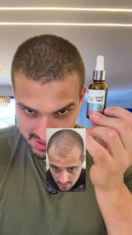 #cabelo #crescimentocapilar #quedacapilar #cabelosaudavel #envyhair 