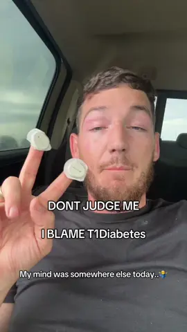 My mind is elsewhere today..stupid Dexcom sensors..#fyp #t1dlookslikeme #type1awareness #diabetesawareness #dexcomg7 