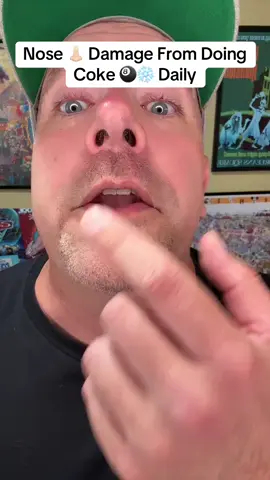 The permanent nose damage from using and what happens #onthisday #addiction #awareness #EduTok #recovery 