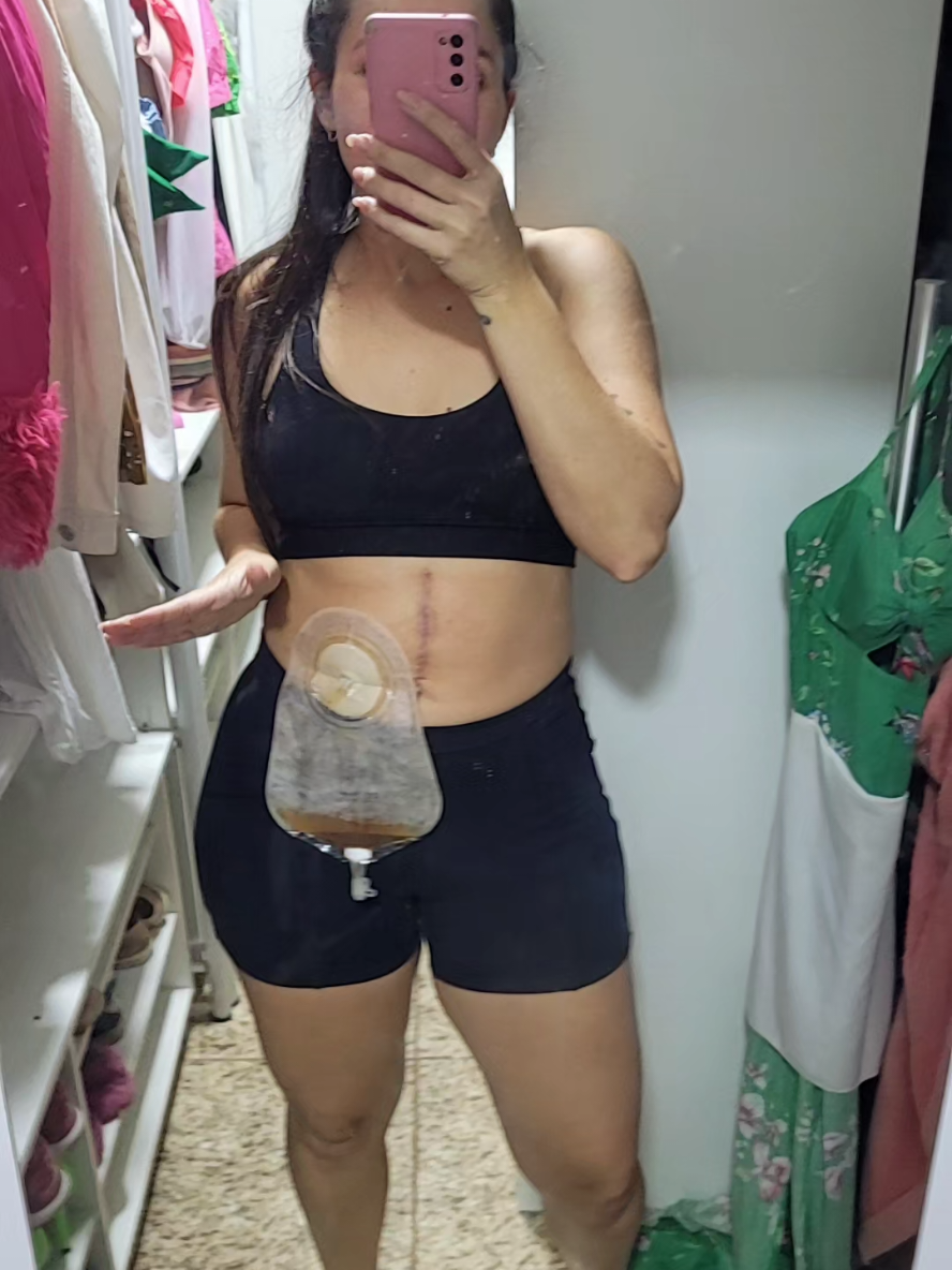 o dia todo, sendo q tenho q fazer repouso! sorroço 😂 #passinhodojamal #fy #trend #foryoupage #viraliza 