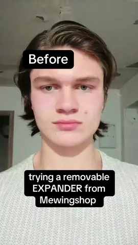 Maxilla is the key 🔑 #transformation #GlowUp #maxilla #health #mewing 