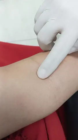 Linda vena 🩸💉  #estadosunidos #nurse #laboratory #paratiiiiiiiiiiiiiiiiiiiiiiiiiiiiiii 