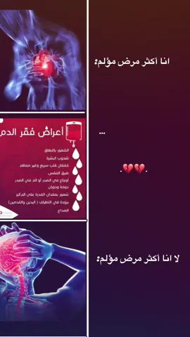 اعراض فقر لدمم 💔! #fypシ #مالي_خلق_احط_هاشتاقات🧢 #fyyyyyyyyyyyyyyyy #اكسبلورexplore 