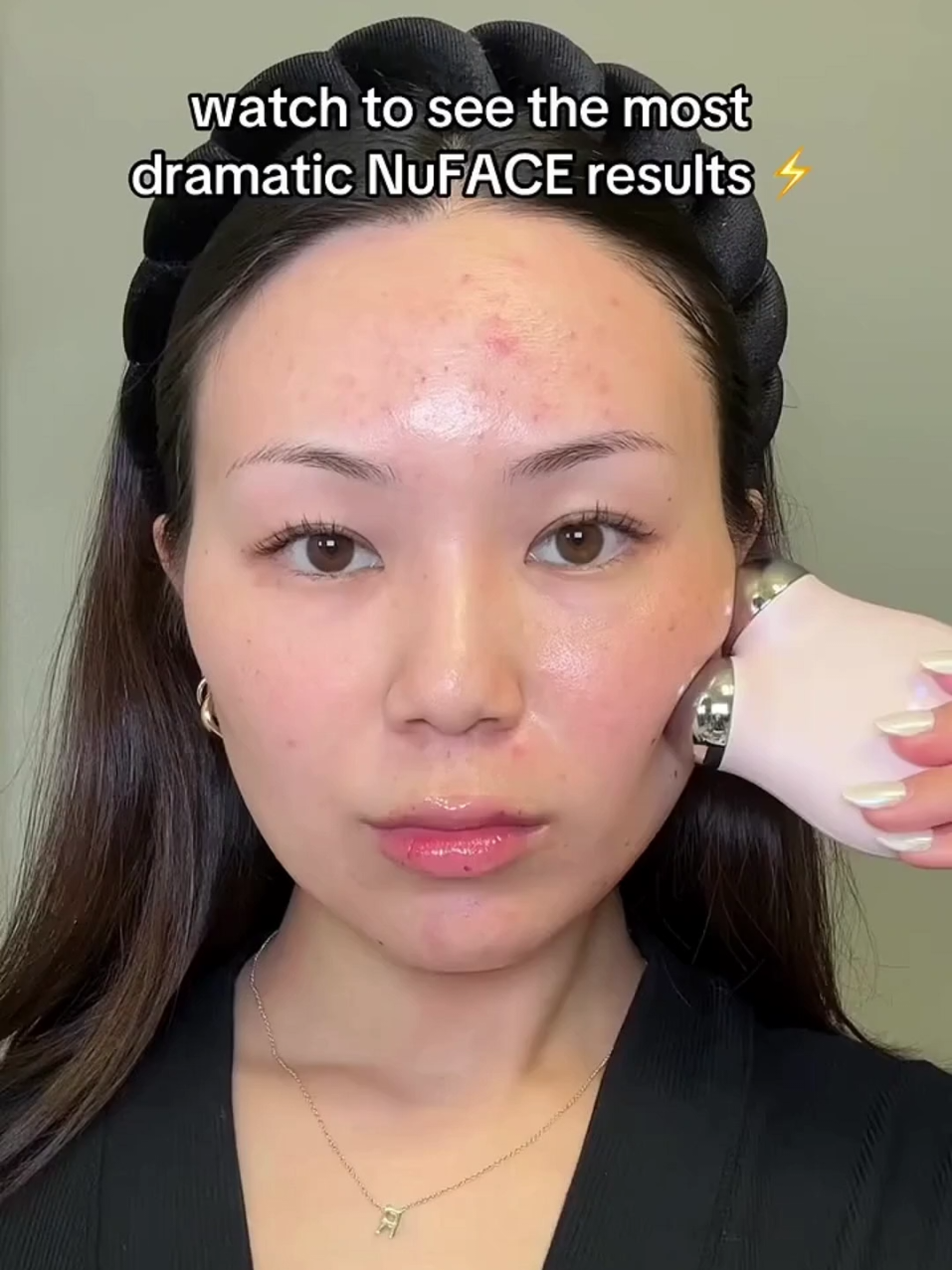 ✨ Your face deserves a glow-up – in just 5 minutes a day! This is NOT just another beauty gadget... It’s a microcurrent facelift you can do at home! I’ve been using the NuFACE Mini and the results? Jawline SNATCHED, skin FIRMER, and glow = UNREAL. 💆‍♀️ Watch to see how I use it and why I’m obsessed! 👀 Link in bio to shop! #nuface  #nufacemini  #microcurrent  #facialtoning  #glowuproutine  #skincaretools #antiaging  #snatchedjawline  #athomefacial  #tiktokmademebuyit  #beautyhack #skincarethatworks  #beforeandafter  #5minutefacial  #skincarereview  #skincaretiktok #trendingbeauty 