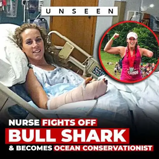 In January 2011, Canadian nurse Nicole Moore was enjoying her last day of vacation in Cancún, Mexico, when her life changed forever. After finishing a game of beach volleyball, she waded into waist-deep water to rinse off when two bull sharks approached the shore. Jet skiers tried to warn her, but before she could react, one of the sharks attacked, and bit into her left thigh. As she tried to swim to safety with only her arms, the shark circled back and clamped onto her left arm, dragging her under the water. In a desperate act, Nicole bravely punched the shark on the nose until it released her, though she was severely injured. Fortunately, a nearby jet-ski pulled her to shore, where bystanders, including nurses, worked quickly to stop the blood loss with improvised tourniquets. She was rushed to the hospital, where doctors fought to save her life during hours of surgery. Nicole survived but lost her left arm, and doctors performed multiple reconstructive operations on her leg to fight infection and repair tissue damage. Her recovery was long and painful, but she never gave up. Just two months after the attack, she walked out of the hospital determined to reclaim her life. Nicole returned to work as a nurse, raised her two daughters, and dedicated herself to supporting shark attack survivors and advocating for ocean conservation. Today, she continues to live with strength and resilience, saying, 