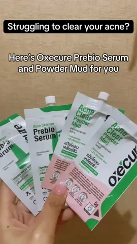 Struggling for treating your acne marks? Holy grail ko rin personally ang duo na to. It worked wonders than those from expensive brands. #oxecure #oxecureph #acneserum #acnemarks 