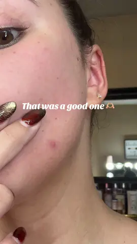 “Breaking out? 😩 It’s not always just your skincare — stress, hormones, diet, dirty pillowcases, or even touching your face can be the culprits! Let’s get to the root cause, not just cover it up 💆‍♀️✨  #SkincareTips #BreakoutCauses #ClearSkinJourney #pimplepopping #GlowWithMe”