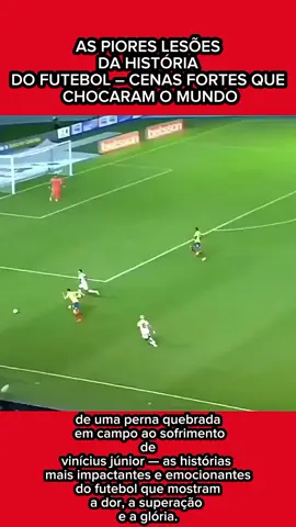 Nem sempre o futebol é só alegria. Em campo, a linha entre o brilho e a tragédia pode ser muito fina. Neste vídeo, mostramos duas das lesões mais chocantes da história do futebol. A primeira, um carrinho desastroso que terminou em uma fratura terrível, deixando todos no estádio em choque. A segunda, o momento de dor e superação de Vinícius Júnior, que mesmo caído no gramado entre lágrimas, se levantou para se tornar um dos maiores jogadores do mundo. Uma lembrança de que, por trás de cada craque, existe um guerreiro que enfrentou a dor, o medo e a crítica — e ainda assim brilhou#Futebol #LesõesFutebol #MomentosChocantes #ViniciusJunior #HistóriasDoFutebol