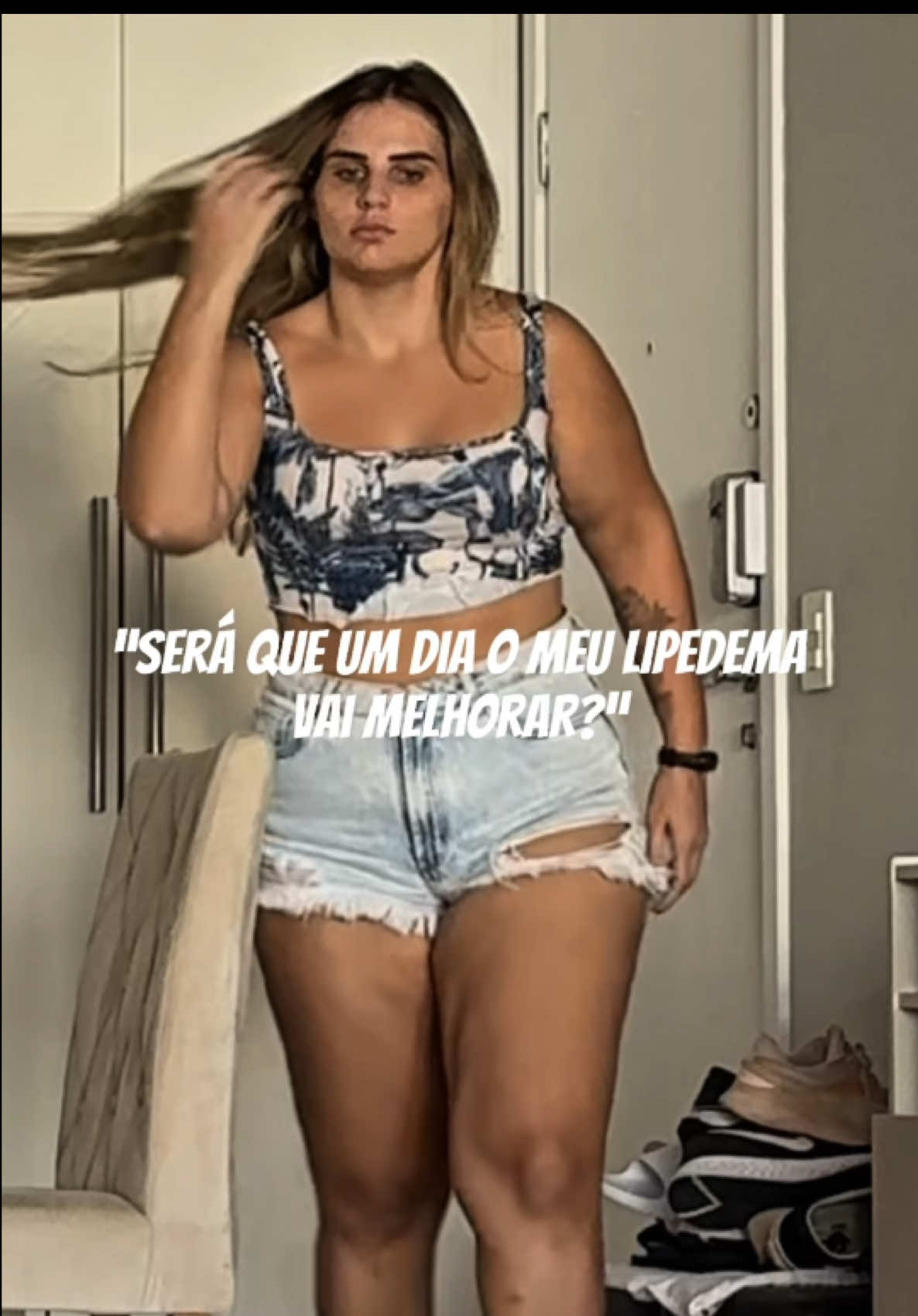 A evolução do meu lipedema!!!! 😱😱 #emagrecimento #fyp #mounjarojourney 