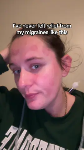 Took my migraine from a 8 to a 3 so fast! 10 minutes on Gua sha setting 7 is what I use for my migraines. I’ve never found anything to give me this type of relief! #facialcuppingmassage #cuppingtherapy #migraine #migraines #migrainerelief 