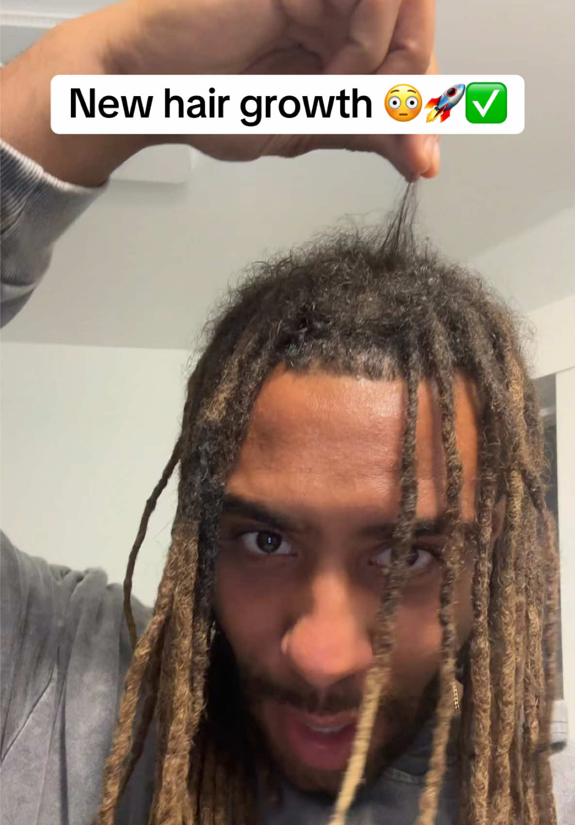 Honduran Botana oil!  #hairgrowth #natural #balding #alopecia 