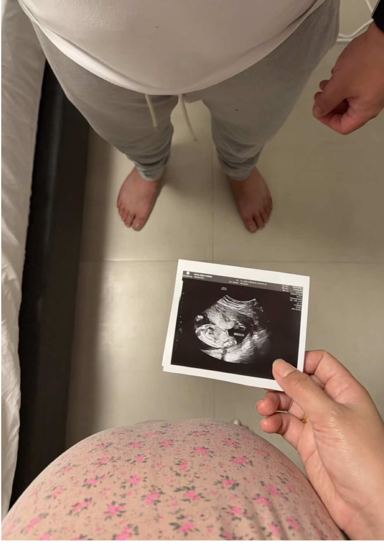 Exchange gift part 2 😍 Second gift 🥰 #pregnant #iPhone17promax #AirPodspro3 #tiffanygold #fyp 