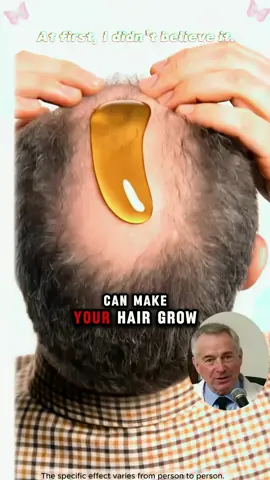 The Batana oil that makes hair grow fast!#batanaoil #gypsophila #hairgrowth #batana #batana 