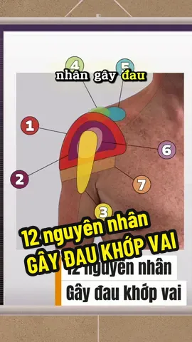 12 nguyên nhân gây đau vai thường gặp #daukhopvai #rachganchopxoay #viemgan #khamkhopvai #bstan @Bs Tân thích khám khớp Vai 