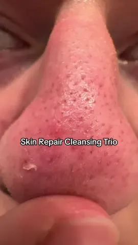 I’m so impressed #beplainskindetox #filtercleanser #skincare #koreanskincare #tiktokshopcreatorpicks