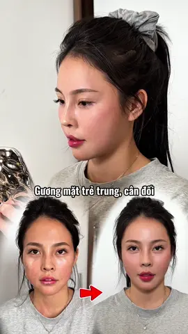 Khách xinh #filler #botox 