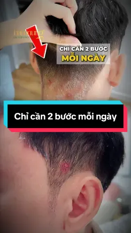 Chỉ cần 2 bước đơn giản mỗi ngày #xuhuong #daugoi #daugoithaoduoc #daugoigiamrung #daugoinamnung 