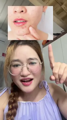 Kem dưỡng giảm mụn nhanh 8h Dou+M của La Roche - Posay #LRPVN #larocheposayvn #chamsocda #larocheposay 
