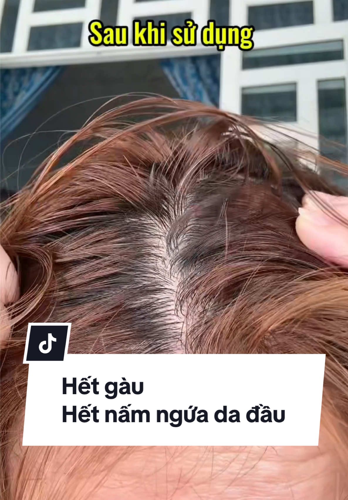 Hiệu quả sau khi dùng #review #xuhuong #daugoitrigau #daugoilemond 