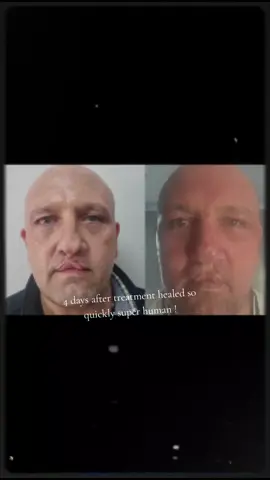 #mentalhealthmatters #men #skincare #health #healthylifestyle 