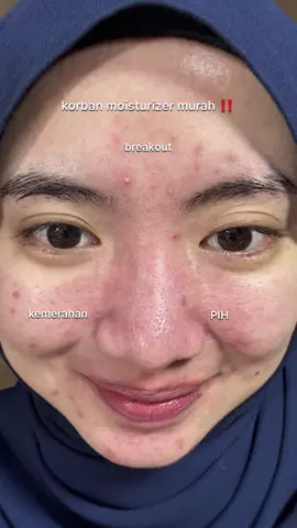 seminggu pake ini kebantu banget, apalagi moistnya nampol 😙👍🏻 #moisturizer #makarizo128 