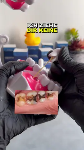 #hydroxyapatite #yellowteeth #karies #gelbezähne #mundgeruch 