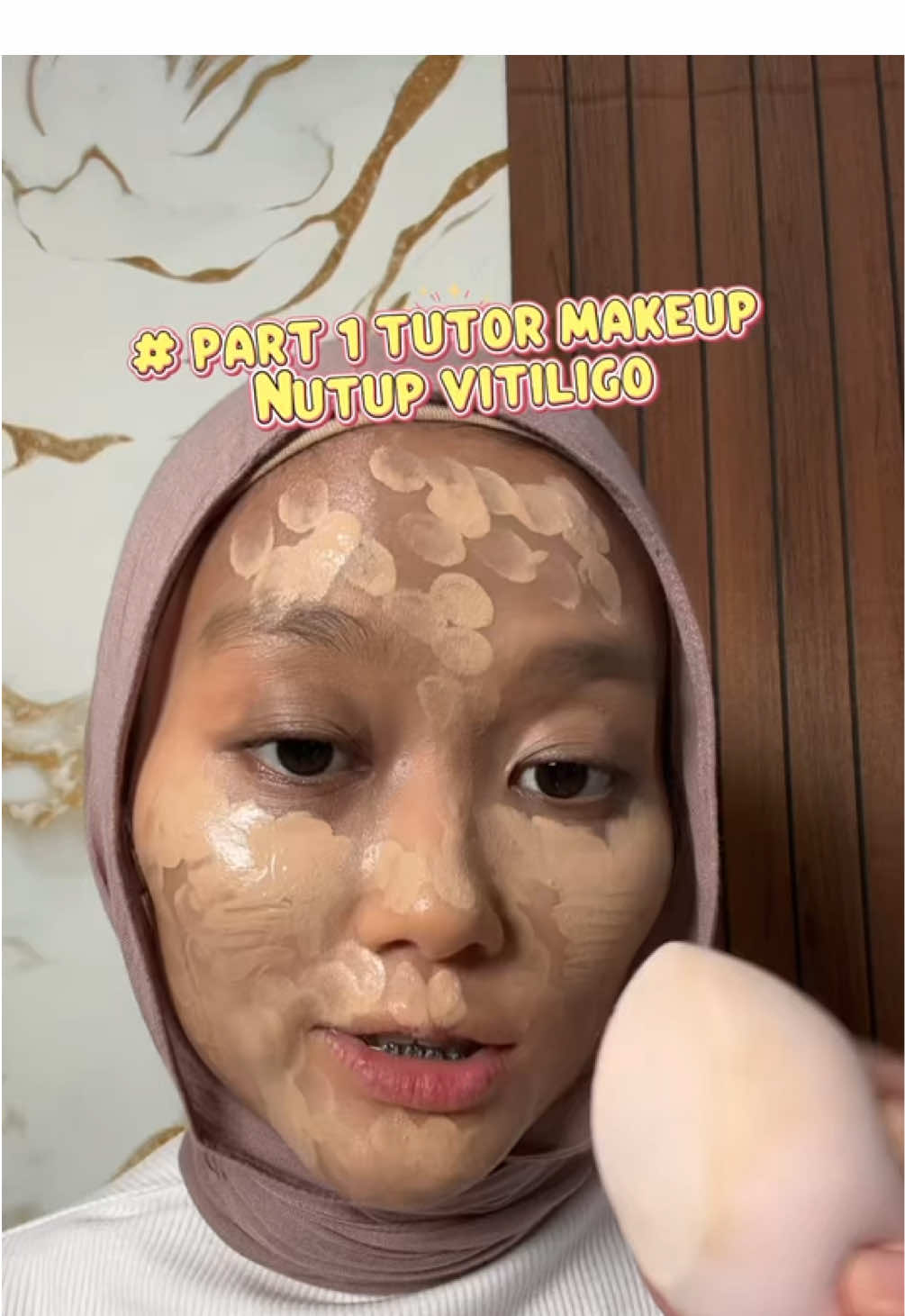 PART 1 | Tutorial, tips, dan trik, Nutupin vitiligo pake makeup, udah aku spill di keranjang kuning apa aja yg aku pake #tutorial #makeup #vitiligo #vitiligogirl 