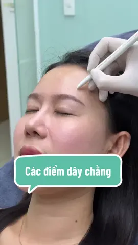 Các điểm dây chằng Linerase#linerase 