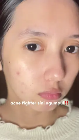 acne fighter harus tau produk @THE FACE 😍‼️ #GlowwithTheFace #TheFaceIndonesia #TheFaceTemulawakBPOM #skincareroutine 