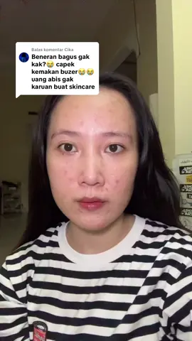 Membalas @Cika skinflair acne spot treatment beneran oke👍🏼 #skinflair #acnespot #skincareviral #rekomendasiskincare #acneproneskin 